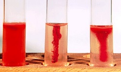 Motility Culture Method